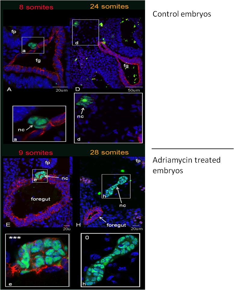 notochord imaging in adriamycin treated embryos